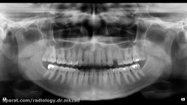 نمونه رادیوگرافی دندان رادیولوژی دهان، فک صورت دکتر نیک زاد