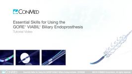 Essential Skills for Using the GORE® VIABIL® Biliary Endoprosthesis