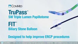 FIT™ Biliary Stone Balloon and TruPass™ SW Triple Lumen Papillotome