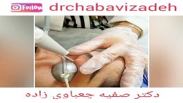 رفع گزانتوم پلک لیزر co2  دکتر صفیه چعباوی زاده