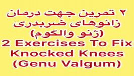 درمان زانوضربدری خدمات پزشکی،کاردرمانی،فیزیوتراپی09122655648در منزل،مطب