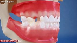 ارتودنسی دندان  کلینیک دندانپزشکی تاج