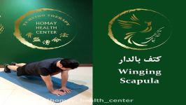 کتف بالدار Winging Scapula