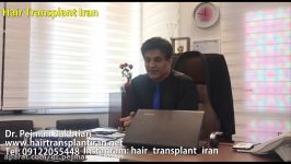 دکتر پژمان بختیاری  تعداد تار مو برای کاشت قسمت اول