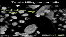سلول T مهندسی شده در حال شکار سلول سرطانی