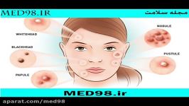 آکنه MED98.ir ریپورتاژ آگهی