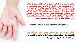 پیشگیری درمان خشکی پوست