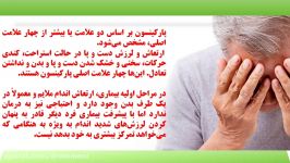 پیشگیری درمان پارکینسون، آلزایمر زوال عقلی