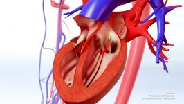 فیبریلاسیون دهلیزی AFib