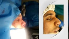 رضایت بیمار جراحی بینی توسط بهترین جراح بینی