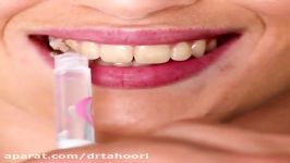 بلیچینگ یا سفید کردن دندان  کلینیک پردیس 02188676014