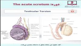 acute scrotum دکتر امینی کارآموزی،کارورزی اورولوژی 48 دقیقه