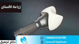 علاج الاسنان في ايران