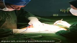 جراحی شکم توسط بهترین فوق تخصص دکتر سینا غیاثی حافظی
