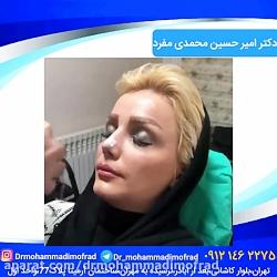 آموزش چسب زدن بینی دکتر امیر حسین محمدی مفرد09215256755