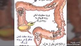 کمک به فرد افسرده ،برای درمان افسردگی