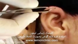 اصلاح فرم لاله گوش در مرکز جراحی سر گردن لیمون