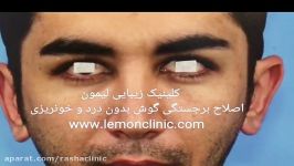 صحبتهای دکتر اکبر بیات در خصوص جراحی زیبایی گوش