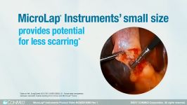 MicroLap® Instruments  CONMED Product Video