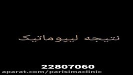 نتیجه لیپوماتیک  دکتر ابدالی  22807060