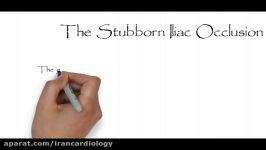 The Stubborn Iliac Occlusion