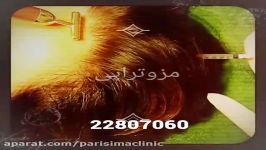 مزوتراپی  کلینیک زیبایی پری سیما  22807060