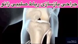 جراحی رباط صلیبی زانو09122655648پزشک متخصص ارتوپدی،فیزیوتراپی در مطب،منزل تهران