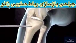 جراحی رباط صلیبی زانو09122655648متخصص ارتوپدی،طب فیزیکی توانبخشی،فیزیوتراپی ته