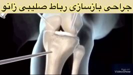 جراحی زانو پزشک متخصص ارتوپدی طب فیزیکی توانبخشی فیزیوتراپی09122655648