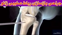 جراحی پزشکی زانو متخصص فیزیوتراپی طب فیزیکی توانبخشی کاردرمانی09122655648