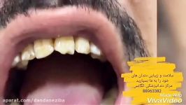 بهترین دندانپزشک تهران  بهترین دندانپزشک زیبایی در تهران