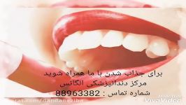 روت کانال  عصب کشی دندان  بریج کردن دندان  اندو دندان