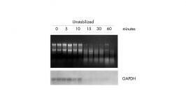 RNA isolation troubleshooting Part 1 RNA degradation