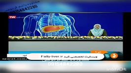 اطلاعاتی در رابطه کبد چرب تیم تحقیقاتی فردوسی