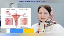 تنگ کردن واژن لیزر مونالیزاتاچ در کلینیک زیبایی BlueTouch