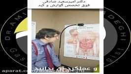 آنچه در مورد کیسه صفرا باید بدانید