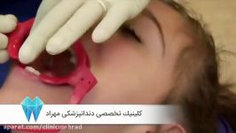سیم ها براکت ها چطور در دهان بیمار قرار میگیرند