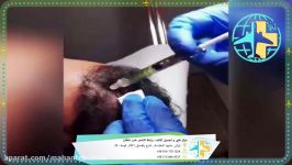 میزوثیرابی للشعر مع مرکز التجمیل طب ماهان فی مشهد