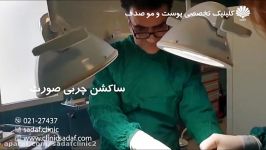 لاغرکردن کوچک گردن گونه تخلیه چربی دهانی