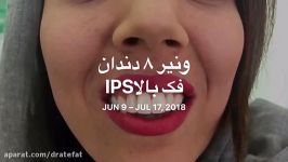دکتر محمد عاطفت متخصص ترمیمی اصفهان اصلاح طرح لبخند کامپوزیت ips