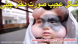 شکل عجیب صورت دختر چینی سوژه رسانه ها شد