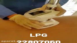 LPG  کلینیک زیبایی پری سیما  22807060