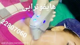 هایفوتراپی  کلینیک زیبایی پری سیما  22807060