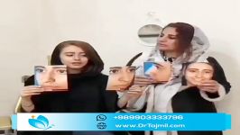 قبل بعد عملیات التجمیل الانف فی ایران  دكتور تجمیل