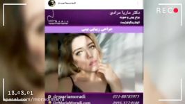 بخشی نمونه جراحی های زیبایی دکتر ماریا مرادی