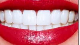 سابلیمینال عربی تصحیح فک رشد دندان جدید دندان های سفید یک رنگ