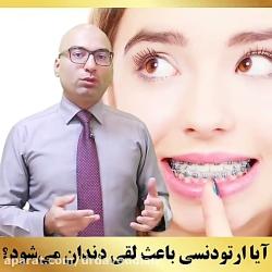 آیا ارتودنسی باعث لق شدن دندان می شود؟  دکتر داودیان