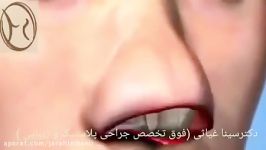 جراحی زیبایی بینی توسط دکتر سینا غیاثی حافظی