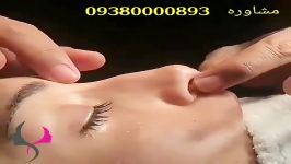 عمل، زیبایی، مشهد، بینی، مشاوره 09380000893