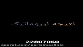 نتیجه لیپوماتیک  دکتر ابدالی  22807060